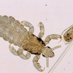 Head louse: nutrition, lifestyle, habitats