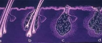 Demodex mites in dog follicles