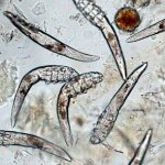 Photo of demodex mites under a microscope