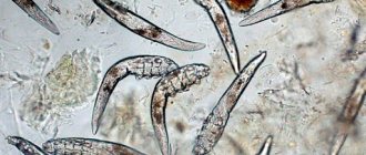 Photo of demodex mites under a microscope