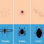 отличие следов укусов разными насекомыми