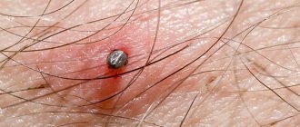 Let&#39;s figure out exactly how a tick bites...