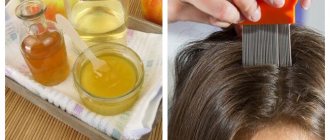 Recipes with vinegar against lice and nits