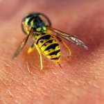 Wasp stings or stings