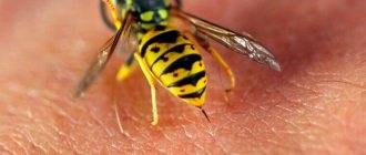 Wasp stings or stings