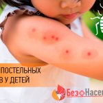 Bedbug bites on children photo