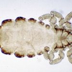 louse under a microscope